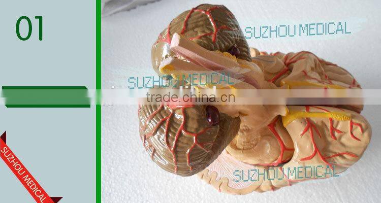Distribution of brain and cerebral arteries
