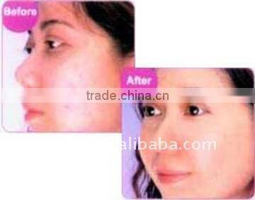 ipl machine photo skin rejuvenation