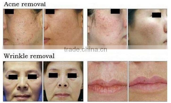 Hot Sale Co2 Cartridge 16g with High Quality