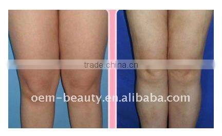 Fat Splitting System Cavitation Machine--F006