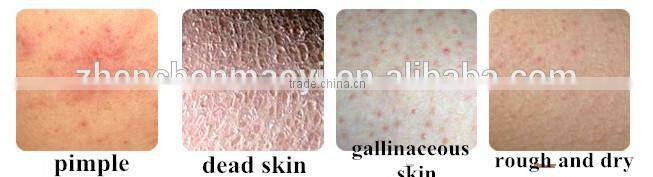 Rose whitening Body Scrub Wholesale/exfoliating gel