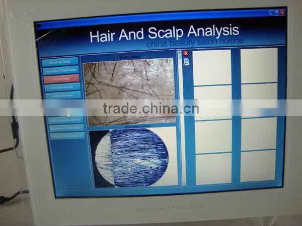 Hair Analysis Software Hair Analyzer