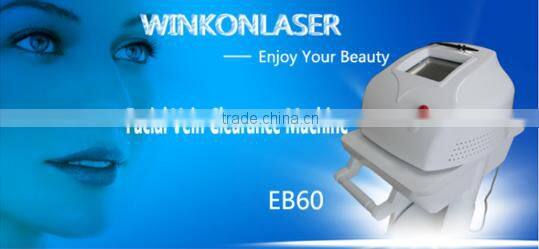 vascular vein spider vein removal rf / high power spider vein removal machine / 30mhz spider vein removal device