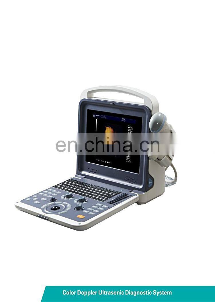 HC-A011 newest portable 4D color doppler ultrasound system