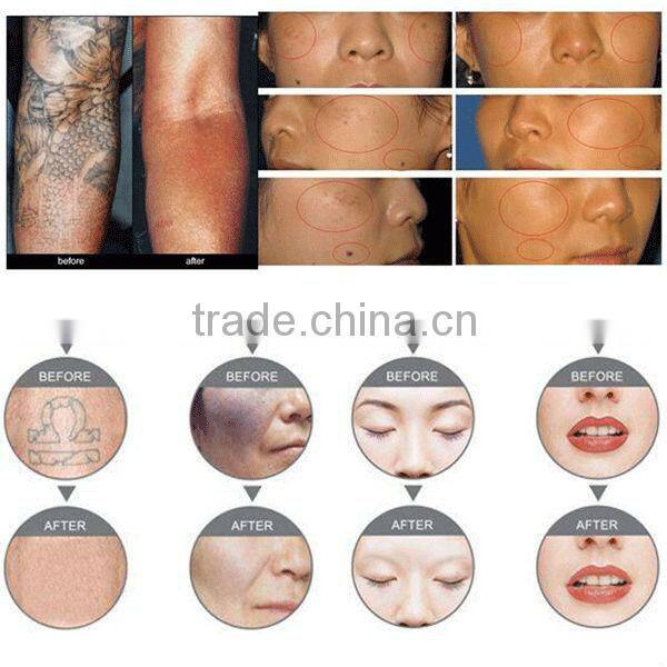 Hot selling Black baby laser cleaning machine