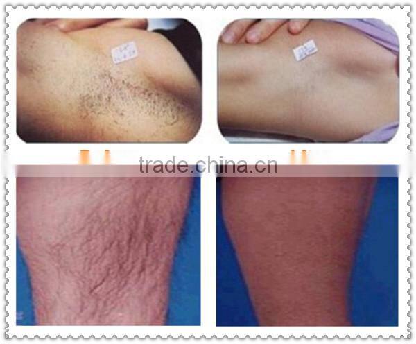 Mini home ipl hair removal machine