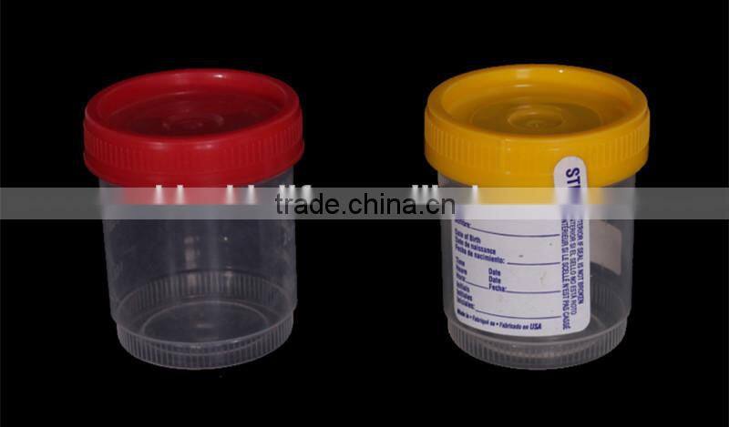 disposal urine specimen container,medical specimen container