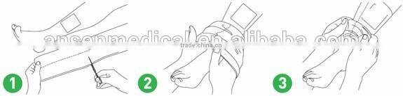 Medical Cotton Tubular Gauze Bandages Surgical Comfortable Orthopedic Tubular Bandage