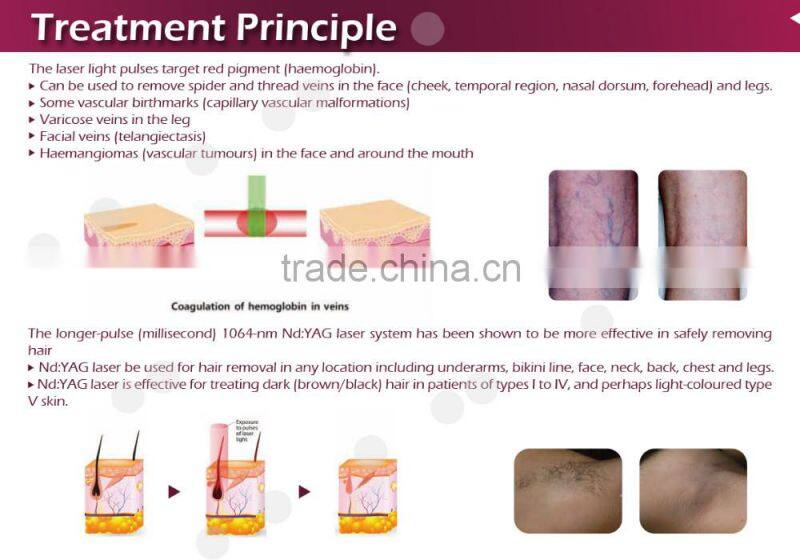 1064 nm / 532nm Professional Q-switched 8ns nd yag laser tattoo removal