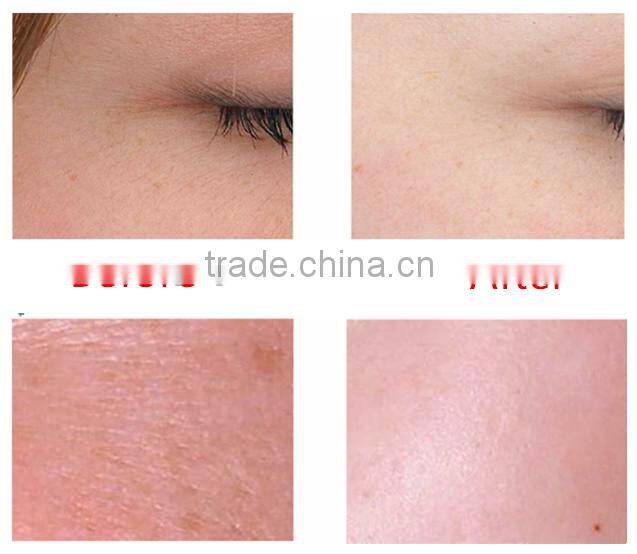 2016 Fashion Design Vetical Pure Oxygen Facial & Water Injection Facial Beauty Machine For Skin Whitening