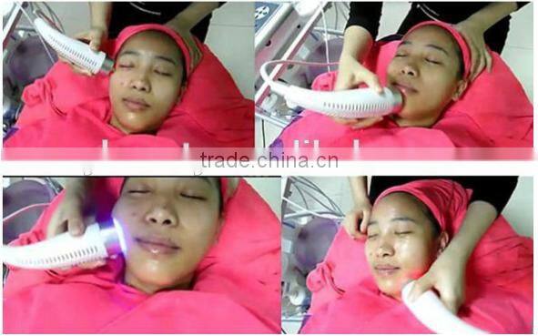 AYJ-T19 rf facial skin lifting equipment