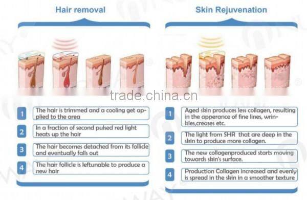 hottest salon use equipment IPL Elight machine