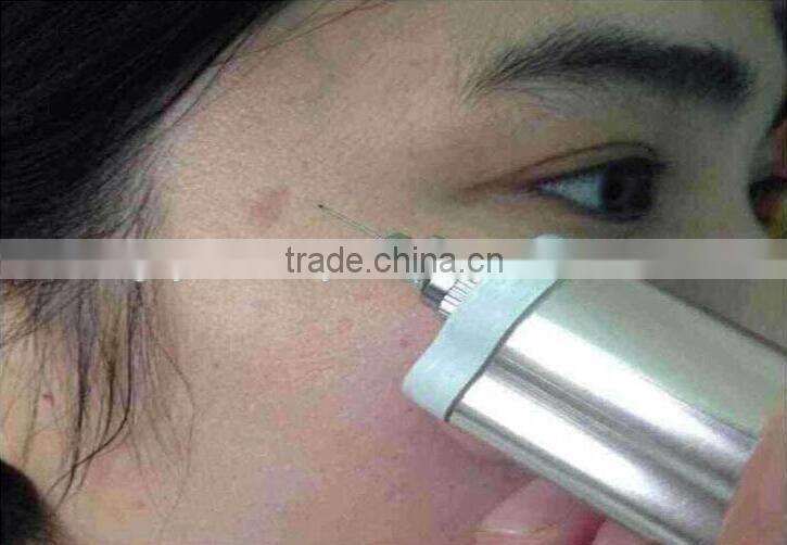 High Frequency Spot Removal Pen speckle removal