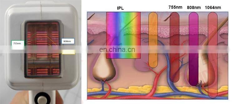 Professional 3 waves soprano hielo platino laser hair removal machine cabezal laser diodo soprano