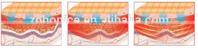 5 in 1 ultrasonic vacuum rf cavitation fat cutting BS08