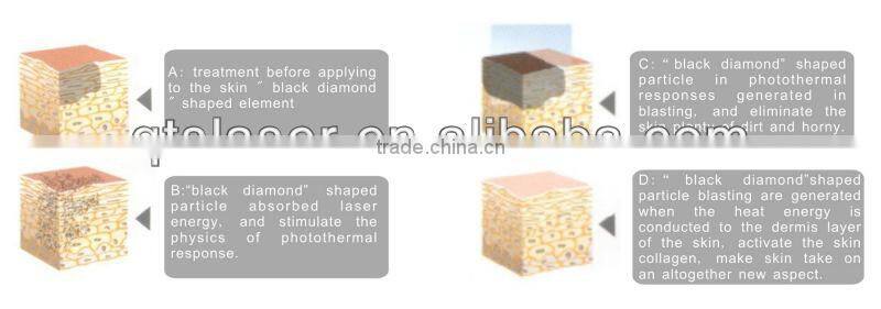 Professional black head removal machine/ black doll