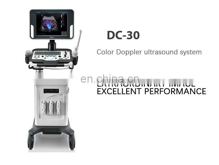 Mindray DC-30 ultrasound equipment/Mindray color doppler ultrasound