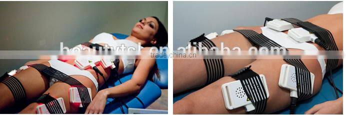 High Quality Professional i lipo laser /cold laser / i lipo machines for sale
