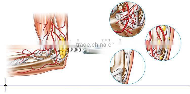 Professional Fast delivery shock wave therapy equipment /pain relief Extracorporeal Shock Wave Machine Therapy System