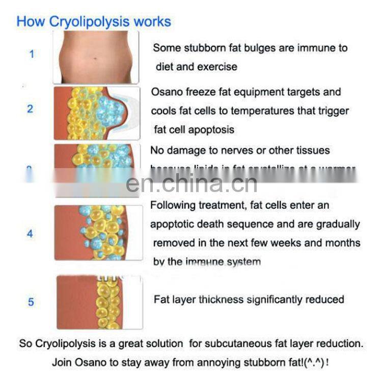 2022 Best 360 Degree Cryo Reduce Fat Slimming Cryotherapy Cryolipolysis Machine