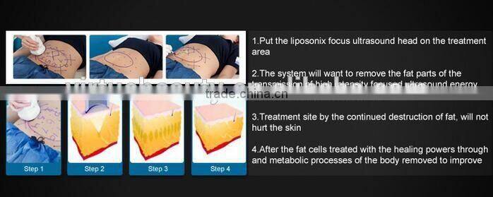 HIFU advanced technology for weight loss High Intensity Focused ultrasound