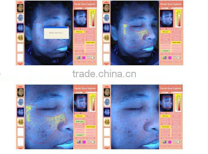 2012 Magic Mirror System/Skin analyser equipment