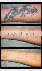 Q Switch Nd YAG Laser 1064 & 532 nm All Colors Tattoo Removal Machine/picosecond tattoo machine