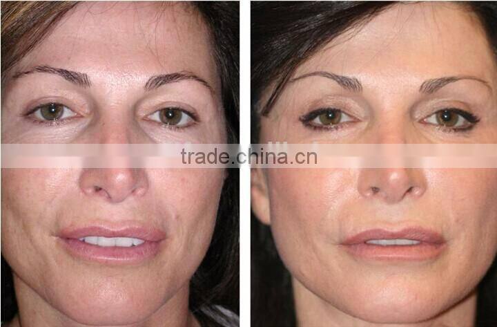 2015 Hot Sale !!! 7 colours pdt led phototherapy neonatal led phototherapy