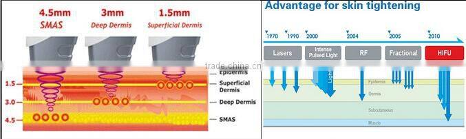 Factory direct selling Low price 3 head pieces 1.5mm&3.0mm&4.5mm hifu face machine anti-aging machine