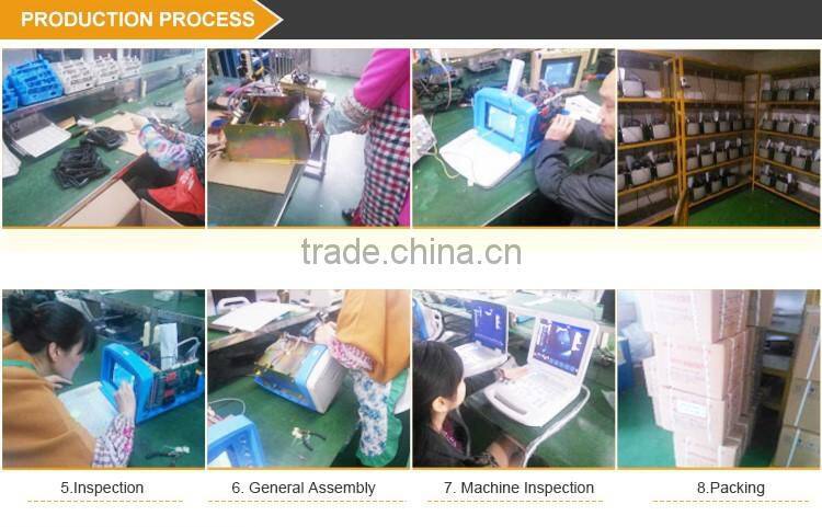 Full Digital LED Ultrasound Scanner B&W ultrasound system