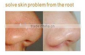 Mini home use and travel use beauty instrument best selling hot chinese products