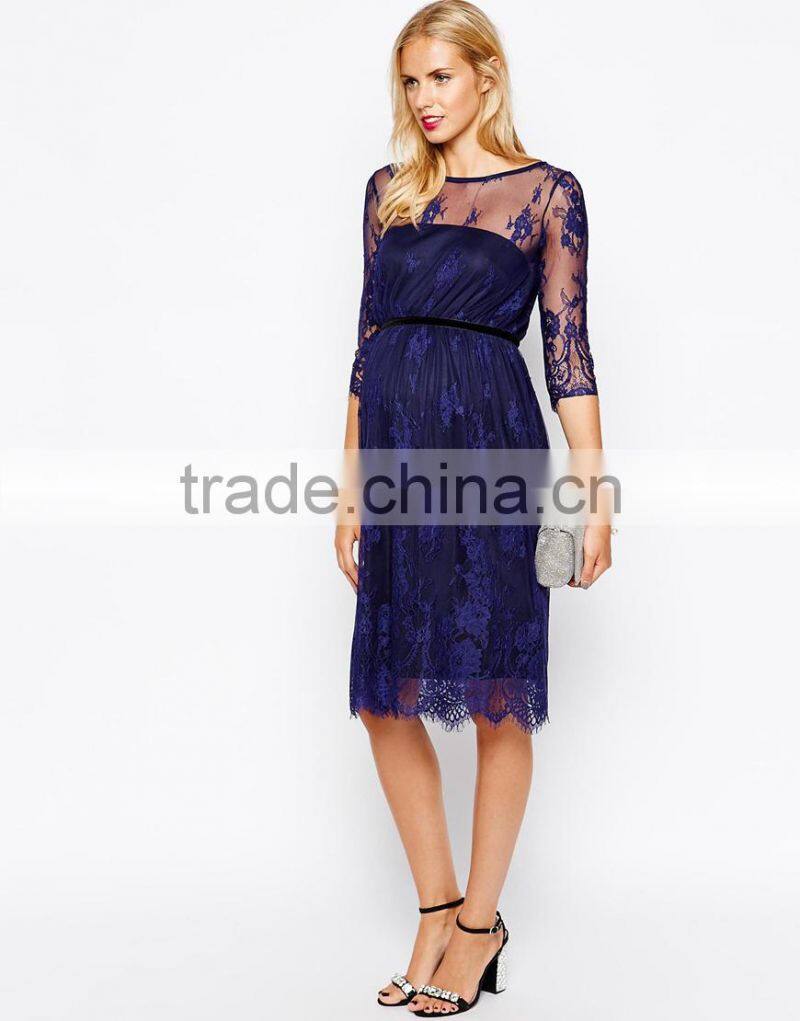 Maternity Lace Midi Dress With Scalloped Detail