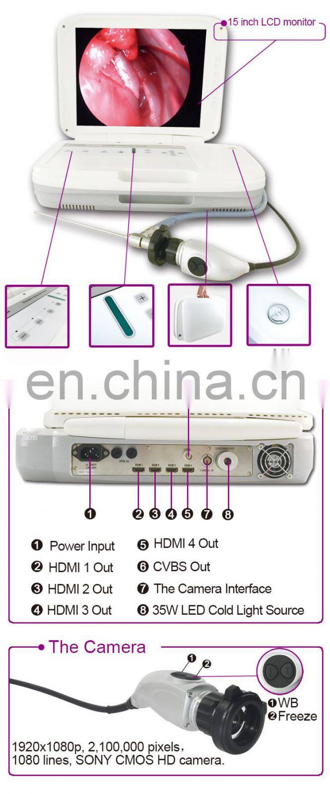 15 inch LCD HD Portable Endoscope Camera for Veterinary diagnosis and surgeries