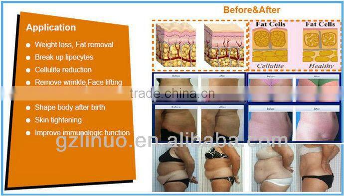 2013-2017 the most Excellent+Effective+Exquisite cavitation sliming machine ( 2-4cm size reduce /time, AMAZING RESULT!!)