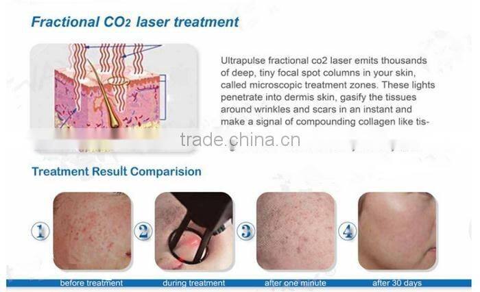 Hot Sale Co2 Cartridge 16g with High Quality