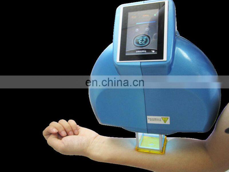 Handheld Excimer Laser 308Nm Psoriasis Vitiligo Laser Unit uv lamp vitiligo For Vitiligo Treatment