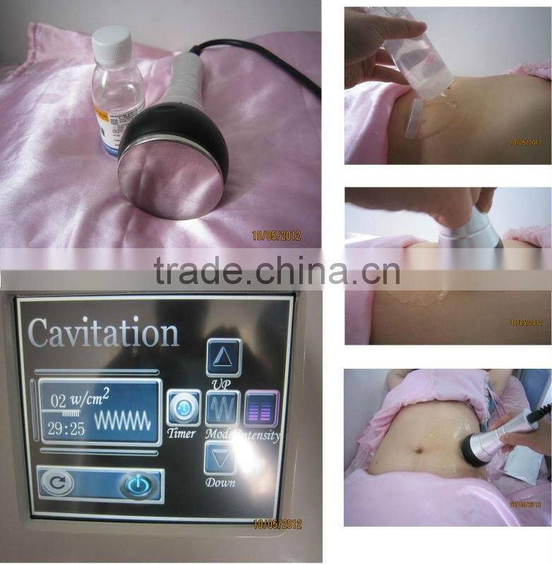 Hotsale 3 in 1 Cryo Slimming Machine with Ultrasonic RF