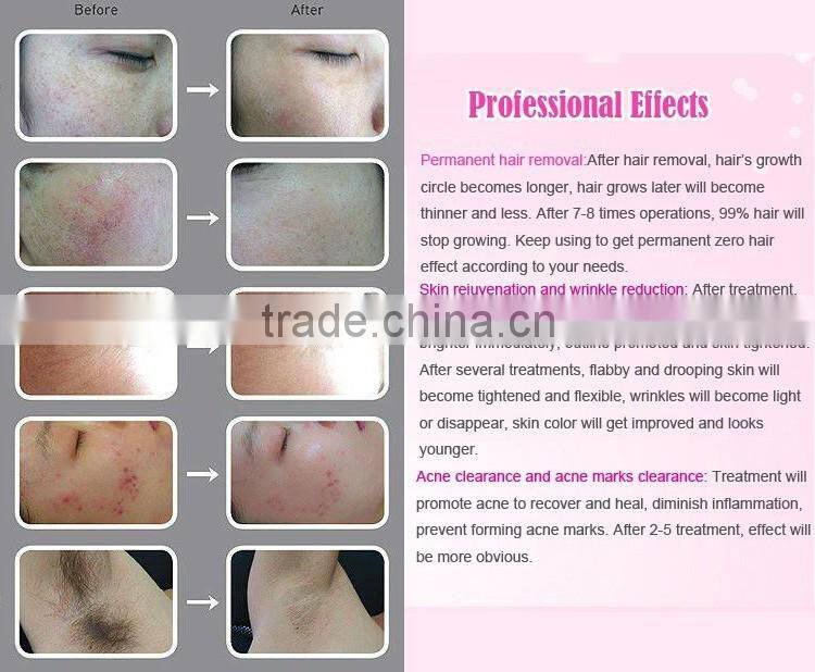 Opt Shr Multi-Functional Beauty Equipment