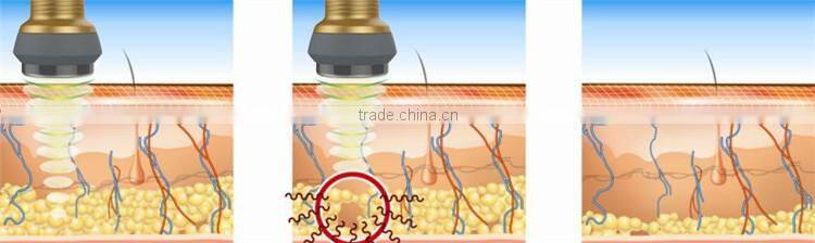 Alibaba China lipo Laser+cavitation+rf Cellulite Reduction Machine