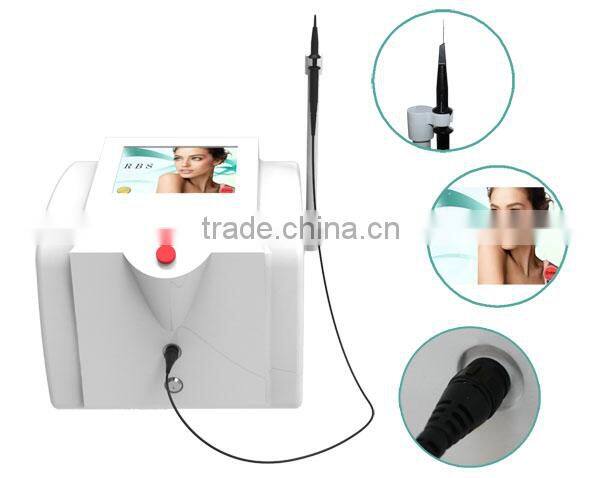 Portable 30MHZ RBS vascular laser spider vein removal machine