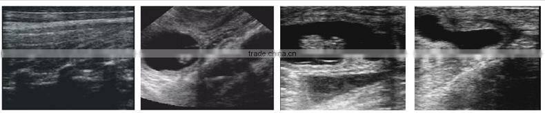 CE & FDA approved palm Veterinary Ultrasound Scanner on sale