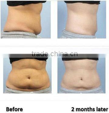 2014 professional portable slimming cavitation ultrasound machine price