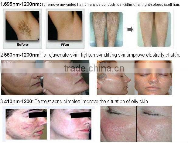 2014 New Portable High Power hair removal epilation ipl beauty equipment for home use