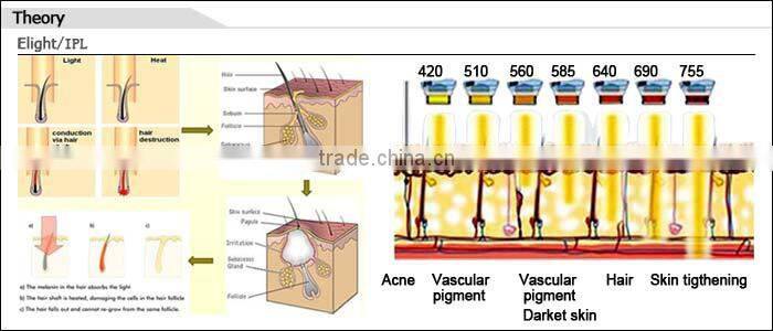 CE Approved 2 years warranty beauty ipl home device