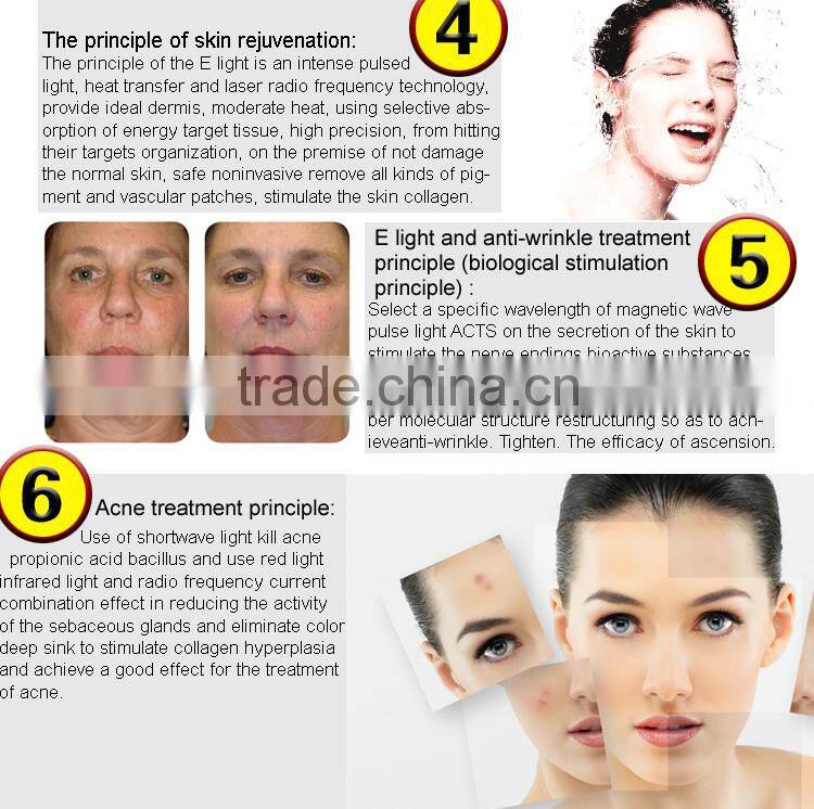 Factory Direct Sales IPL Laser Lair Removal Power Supply Photo Rejuvenation machine in Renlang Beauty Machine