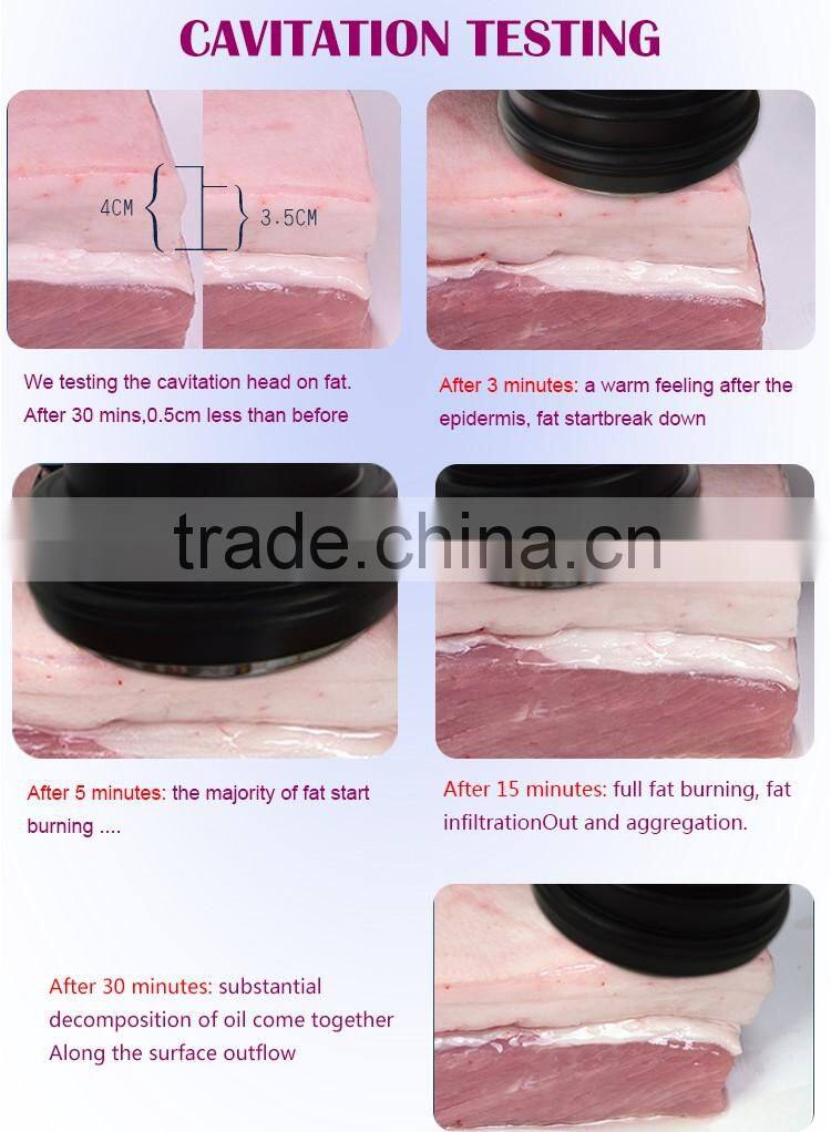 5 in 1 fast cavitation rf machine korea