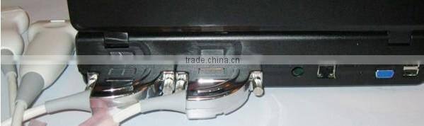 Full Digital Laptop Ultrasound Scanner(PC)
