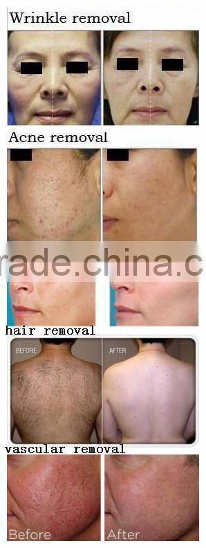 Mini Home Laser Elight IPL Permanent Hair Removal/IPL RF Facial Skin Rejuvenation Machine