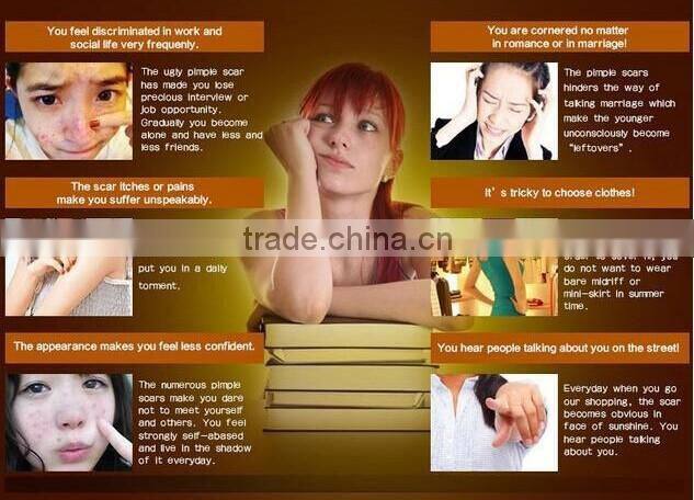 NEWEST! Face Whitening Acne scar Treatment and Pimple Removal Cream