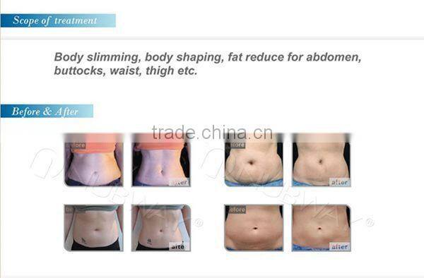 Newest body shaping machine HIFUSHAPE no side effect ultrasonic slimming machine